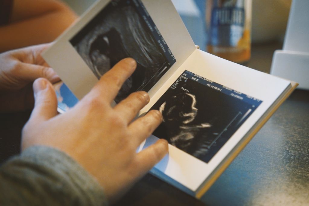 Closeup on hands holding a book open to a couple of baby sonogram images